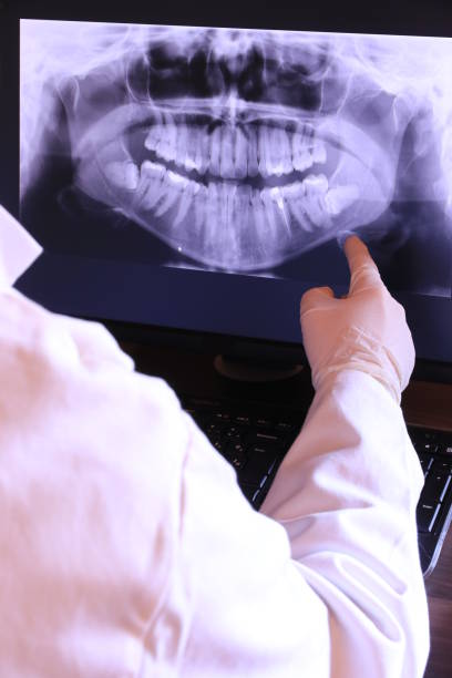 Best Emergency Tooth Extraction in Pembroke, GA