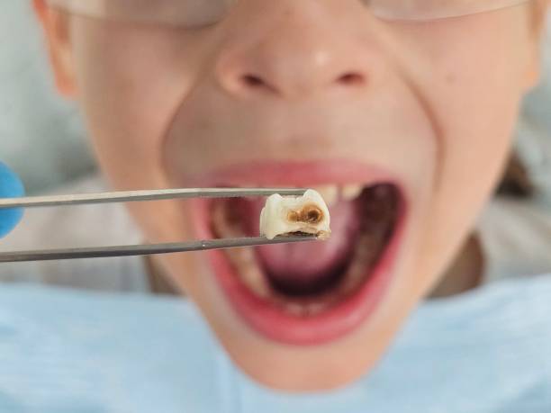 Best Walk-In Emergency Dentist in Pembroke, GA